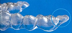 invisalign_06c