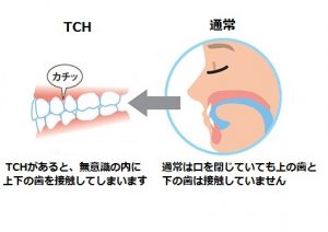 TCH②