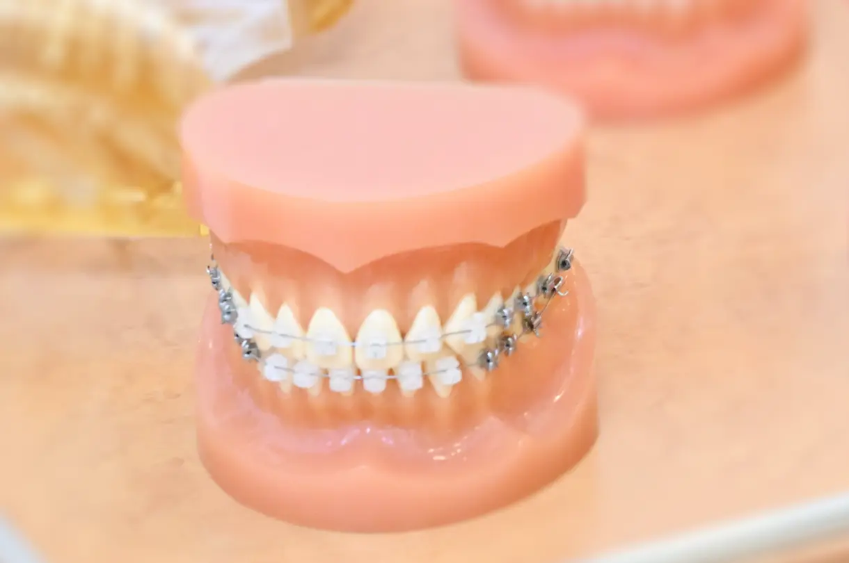 装置の審美性の向上