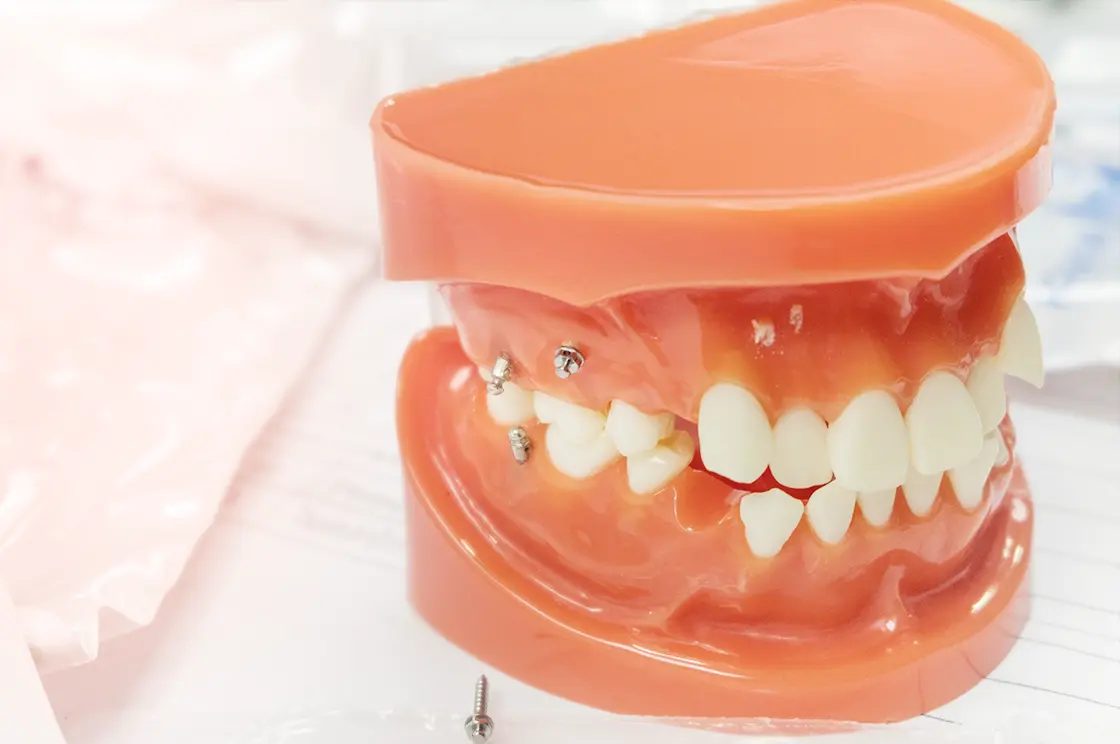 装置の違和感の「軽減」