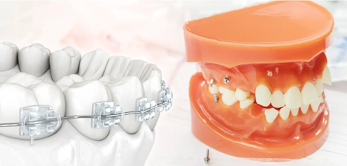 治療期間を短くするための方法