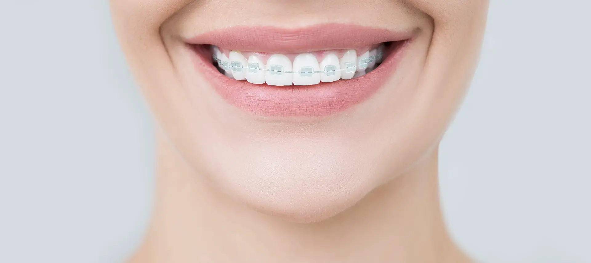 大人の矯正歯科（成人矯正）