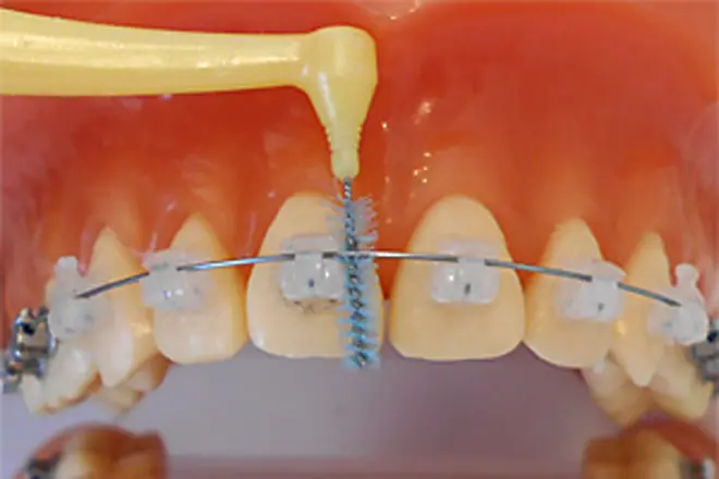 装置の周囲を歯間ブラシで磨きます。