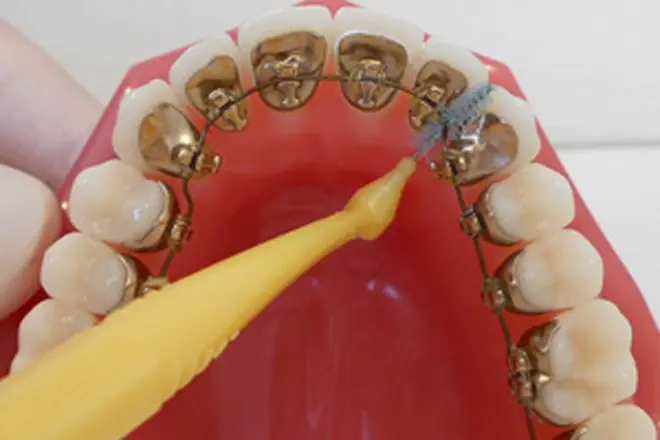 装置の周囲、歯と歯の間を歯間ブラシで磨きます。