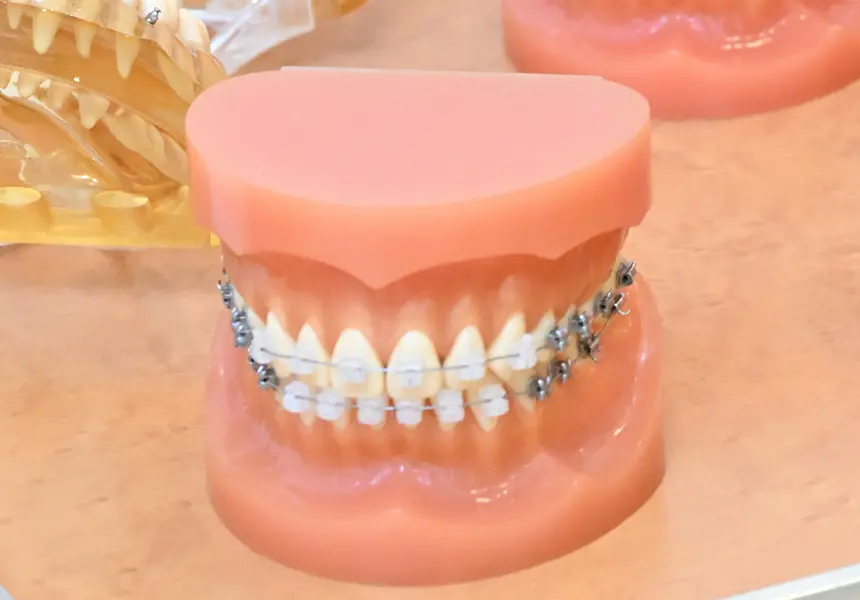 装置の装着（約90分）