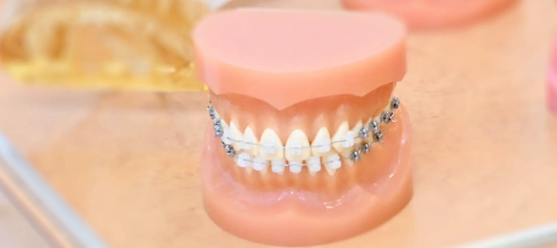 セルフライゲーションブラケット装置（デイモンシステム）