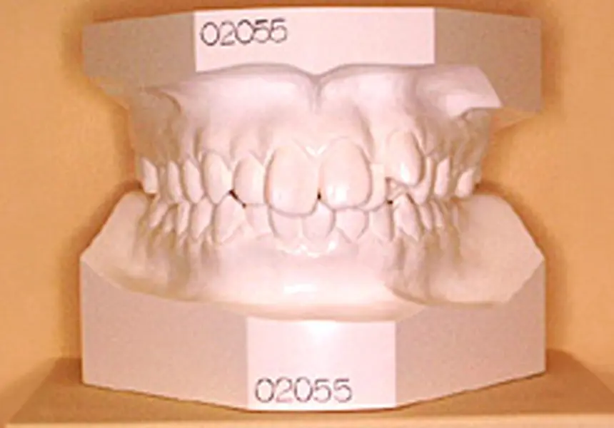 精密検査（約30分）