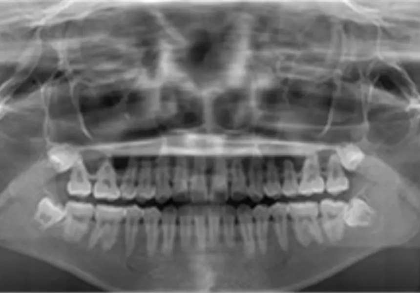 精密検査（約30分）