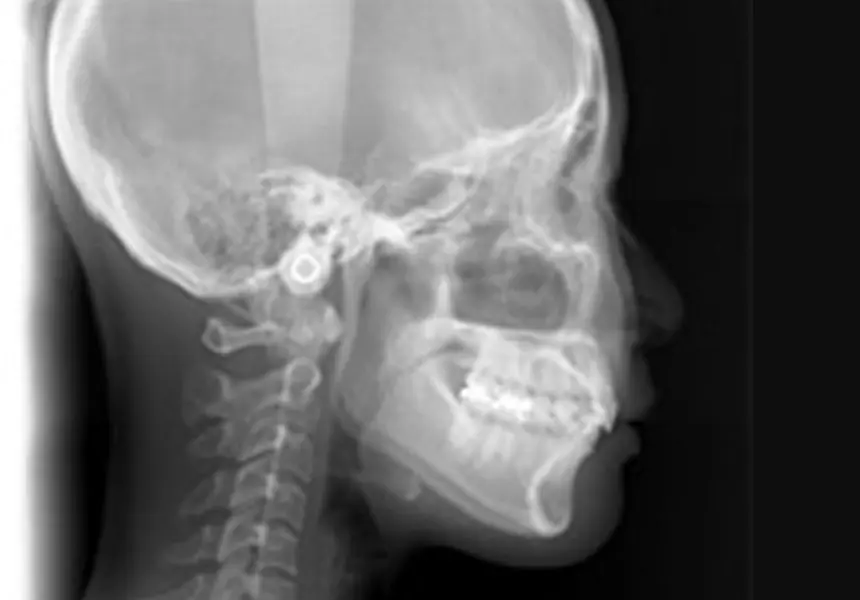 精密検査（約30分）