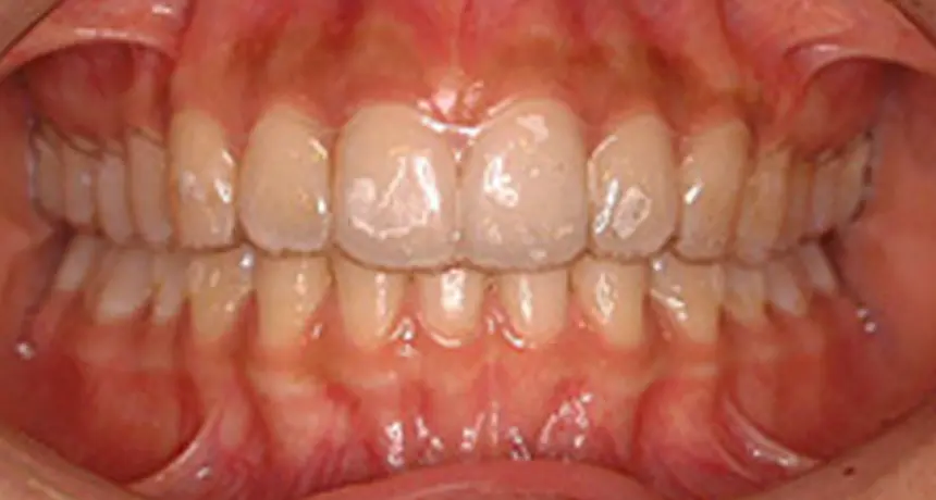 診断（約60分）