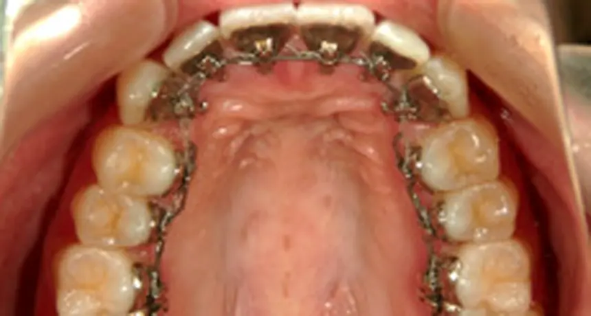 診断（約60分）