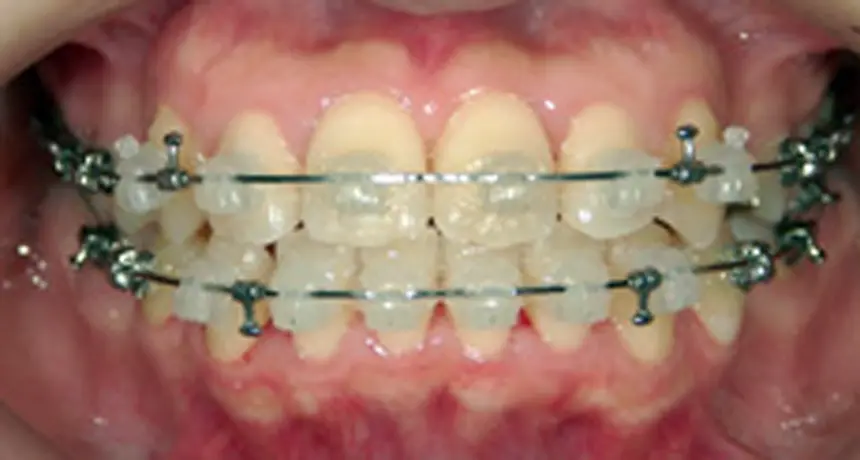 診断（約60分）