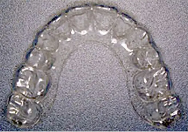 マウスピースType