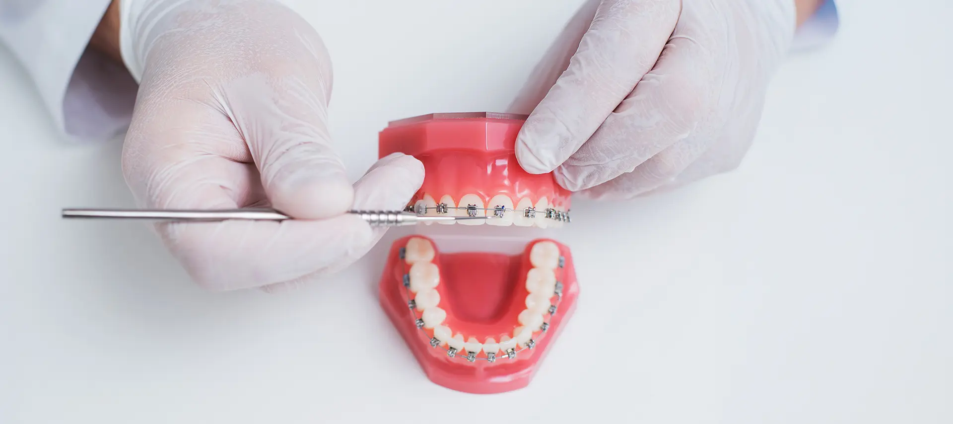 コルチコトミー（歯槽骨皮質骨切除術）