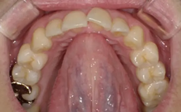 スポットポジション