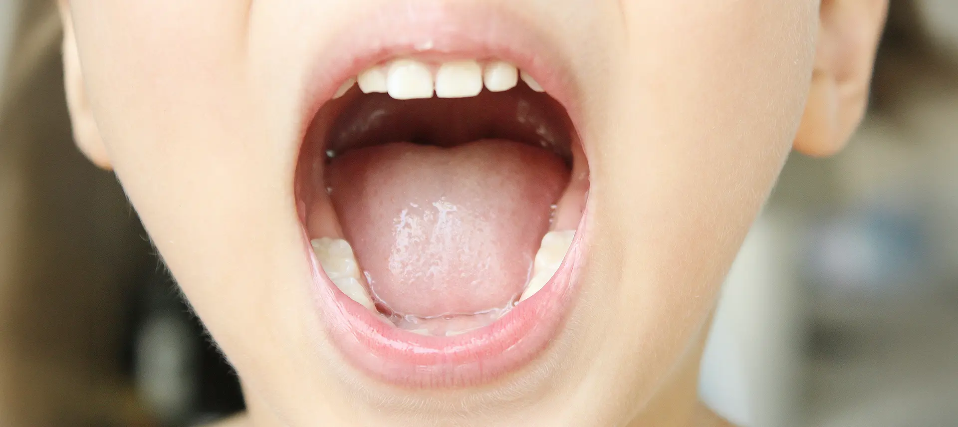 口腔筋機能療法（MFT）