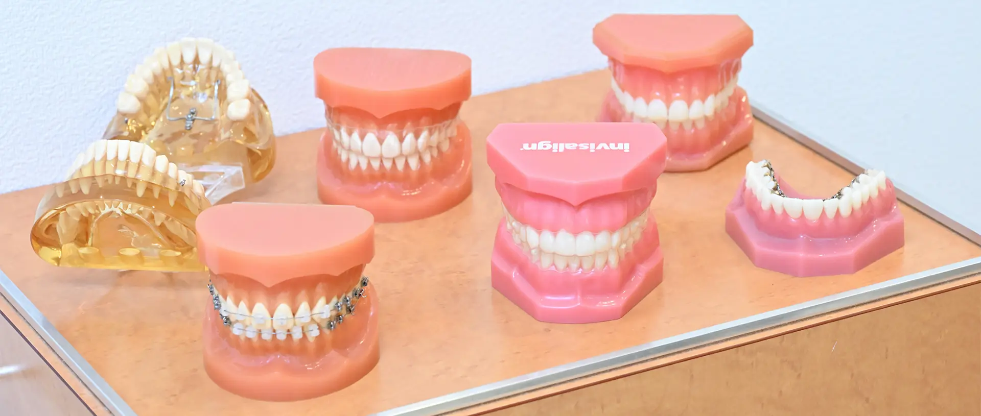 矯正装置の選び方