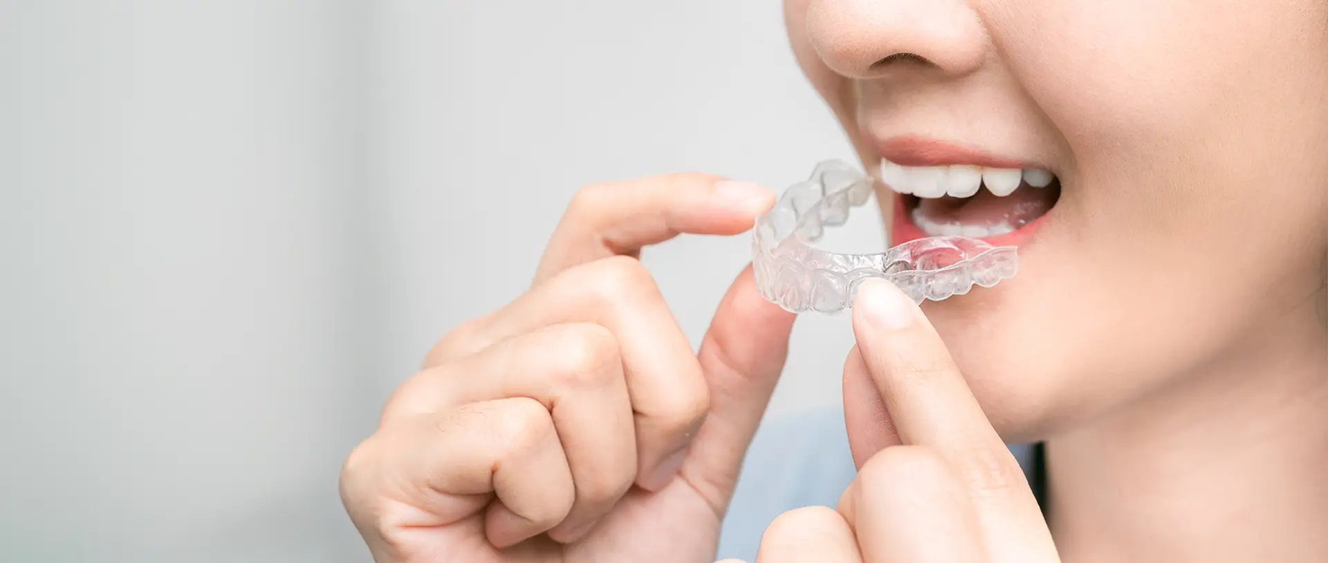 治療中のお願いと治療後について