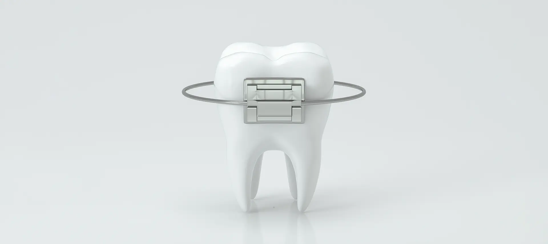 部分的な矯正（MTM）