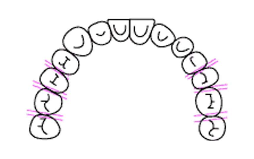 削って隙間をつくる