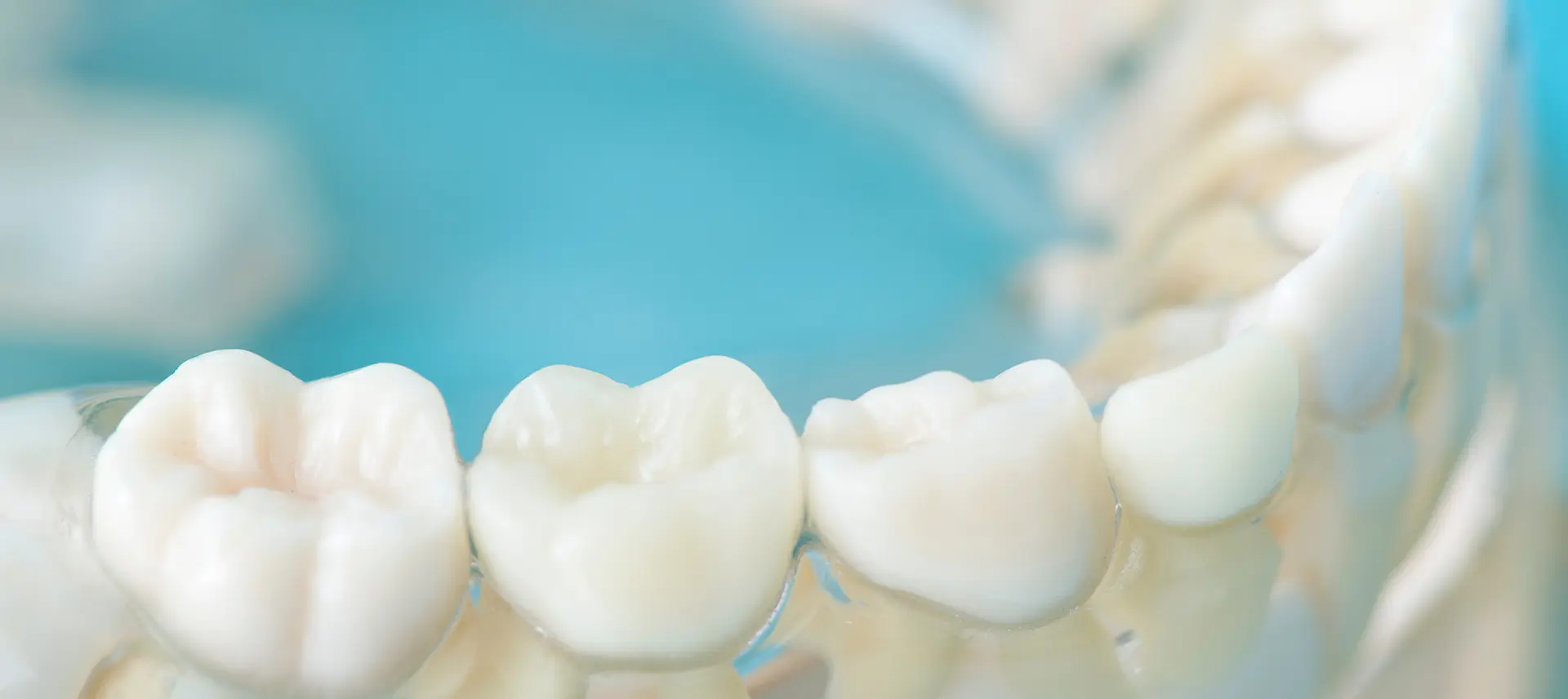 できるだけ歯を抜かない矯正