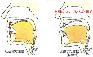 正しい嚥下