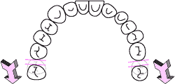 奥歯の移動