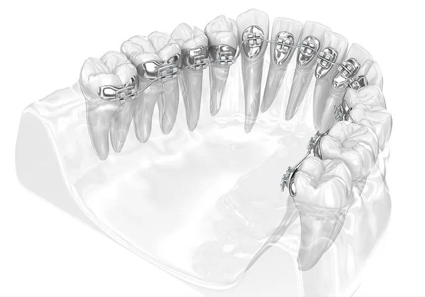 装置の装着（90分）